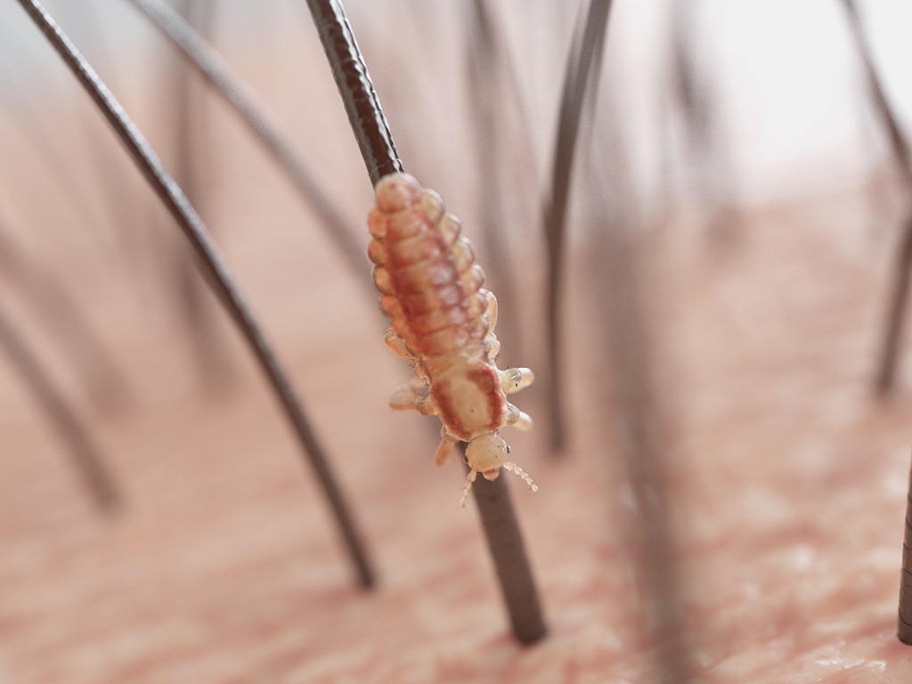 Can You Die From Lice? Is It Reality or Just a Myth? LiceDoctors